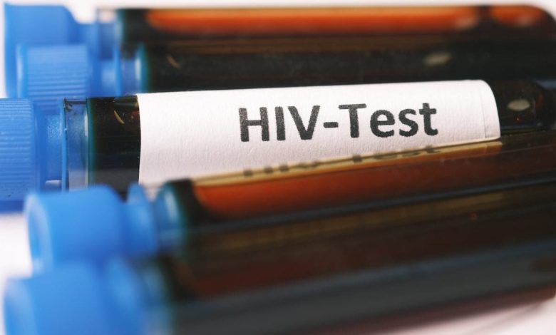 Кому і в яких випадках потрібно обов'язково пройти тестування на ВІЛ — експерти 1 pexels towfiqu barbhuiya 10963257 e1700466865854