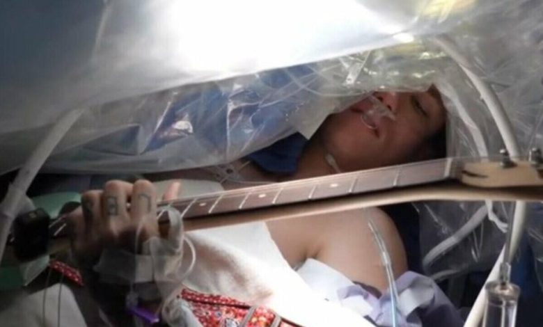 musician plays guitar while surgeons remove his brain tumor 1 1 e1705059102305